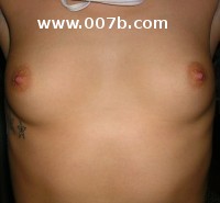 34A breasts
